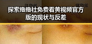 探索擼擼社免费看黄 视频官方版的现状与反差